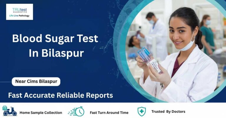Blood Sugar Test in Bilaspur at Life Line Pathology Near CIMS Bilaspur