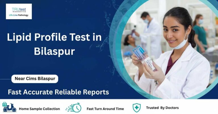 Lipid Profile Test in Bilaspur at Life Line Pathology Near CIMS Bilaspur