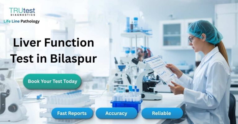 liver-function-test-lft-bilaspur-lifeline-pathology.jp